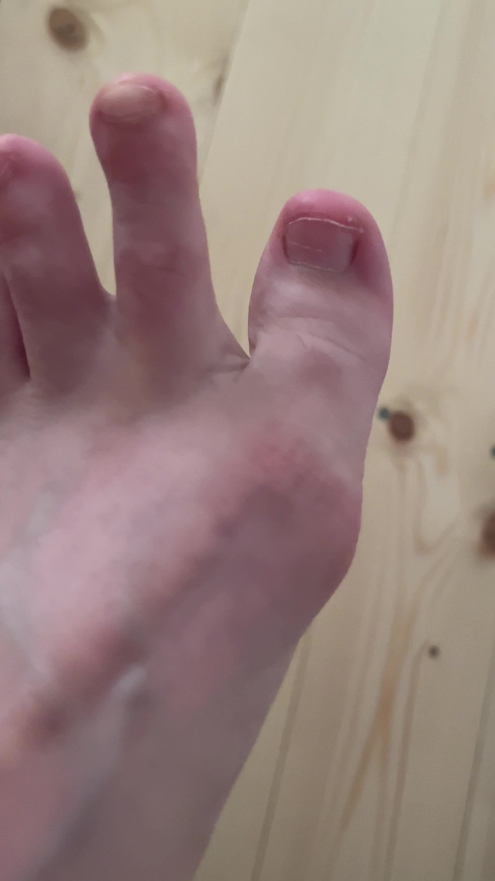 Feet: Att gå barfota