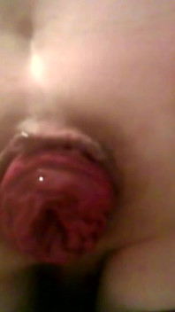 A Young Hot Guy Sitting on a Chair Shows His Anal Prolapse