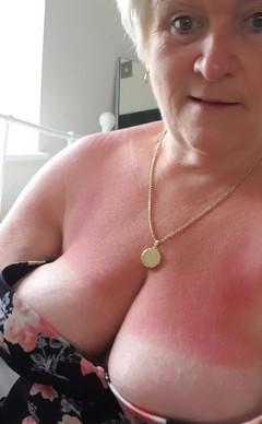 Uk Joolz: Красные сиськи от сидения на солнце слишком долго вчера!