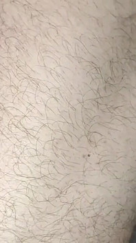 Side-lying Hairy Pussy & Ass - Quick Backside Fuck