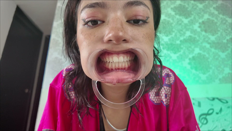 KiyuSweetCrazy: Cheeks Pulled Apart Teeth Exposed