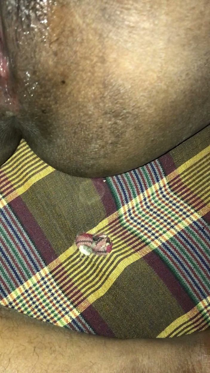Horriblethunderfuck: My Boyfriend Playing with My Pussy Face Not Visible