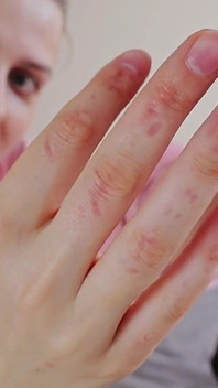 Biting Fingers for the First Time