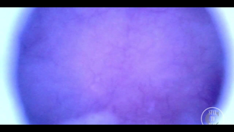 Lina Free: Hermoso interior en primer plano de mi vejiga llena con...