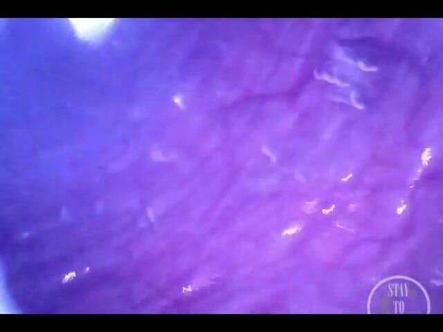 Lina Free: Pumping Air Into My Full Bladder with the Minicam Inside