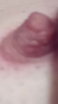Nipples