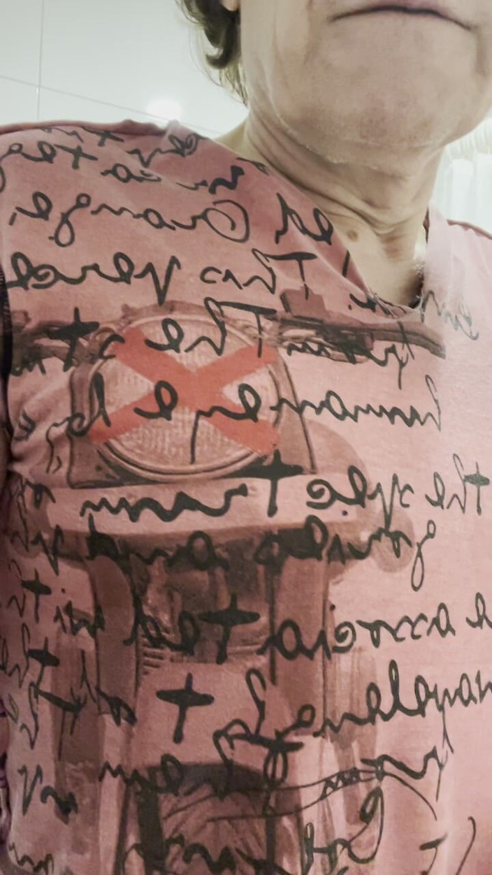 Mitchie: İdrara Gidiyorum