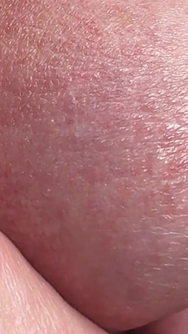 Sperm Close-up Front (Leonardo-1974)