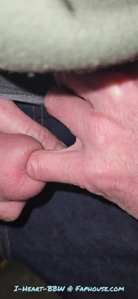 Gaping Urethra - Marker and Pinky Insertion