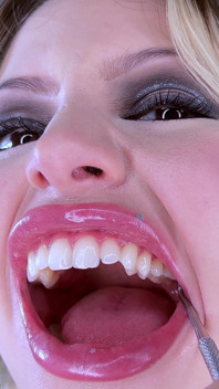 Esame dentale estremo fetish dei denti
