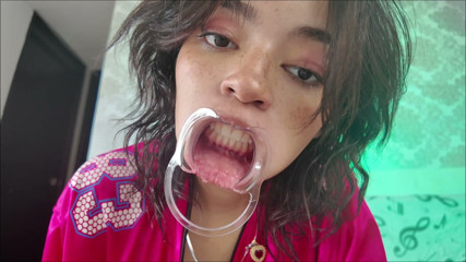 KiyuSweetCrazy: Cheeks Pulled Apart Teeth Exposed