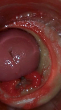 Kamera in tiefe muschi fängt riesige Ejakulation von sperma ASMR ein
