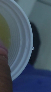 Método Caseiro De Congelamento Do Pênis.