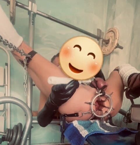 Analguy: Kéo dài mới