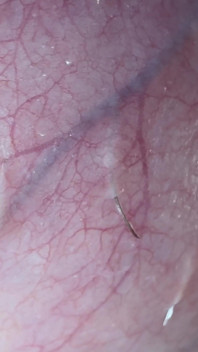 Testicle Massage