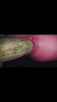 Anal Dilatation Gaping Hole