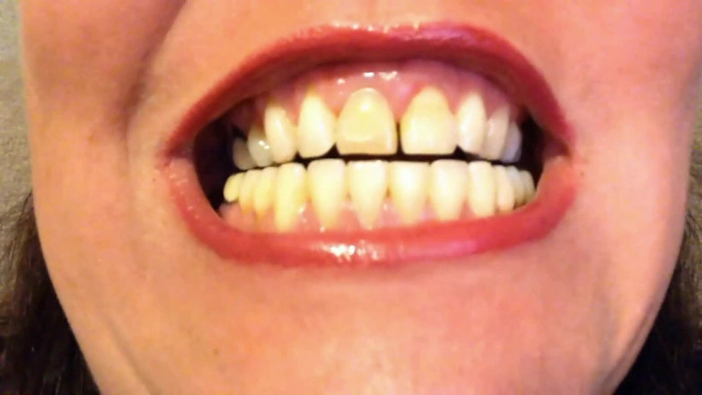 Lily Lipstixxx: Mouth inspection - Be careful, I bite!