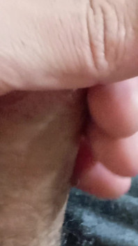 My Dick