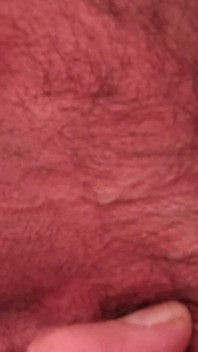 I Spread My Anal Opening.