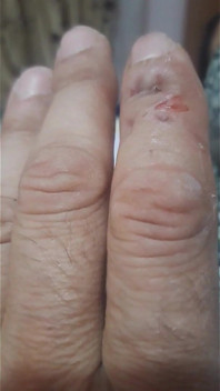Muscatura De Deget