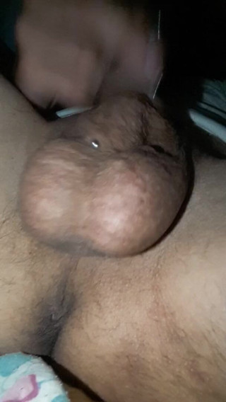 Renoreis: Giới thiệu.