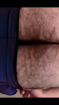 Solo analne