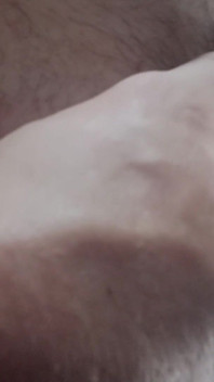 7547744