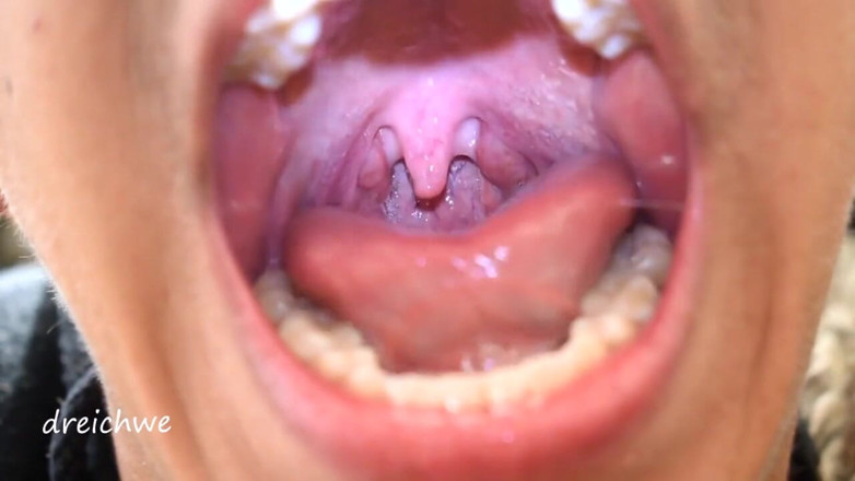 Dreichwe: Uvula, fétiche de la bouche