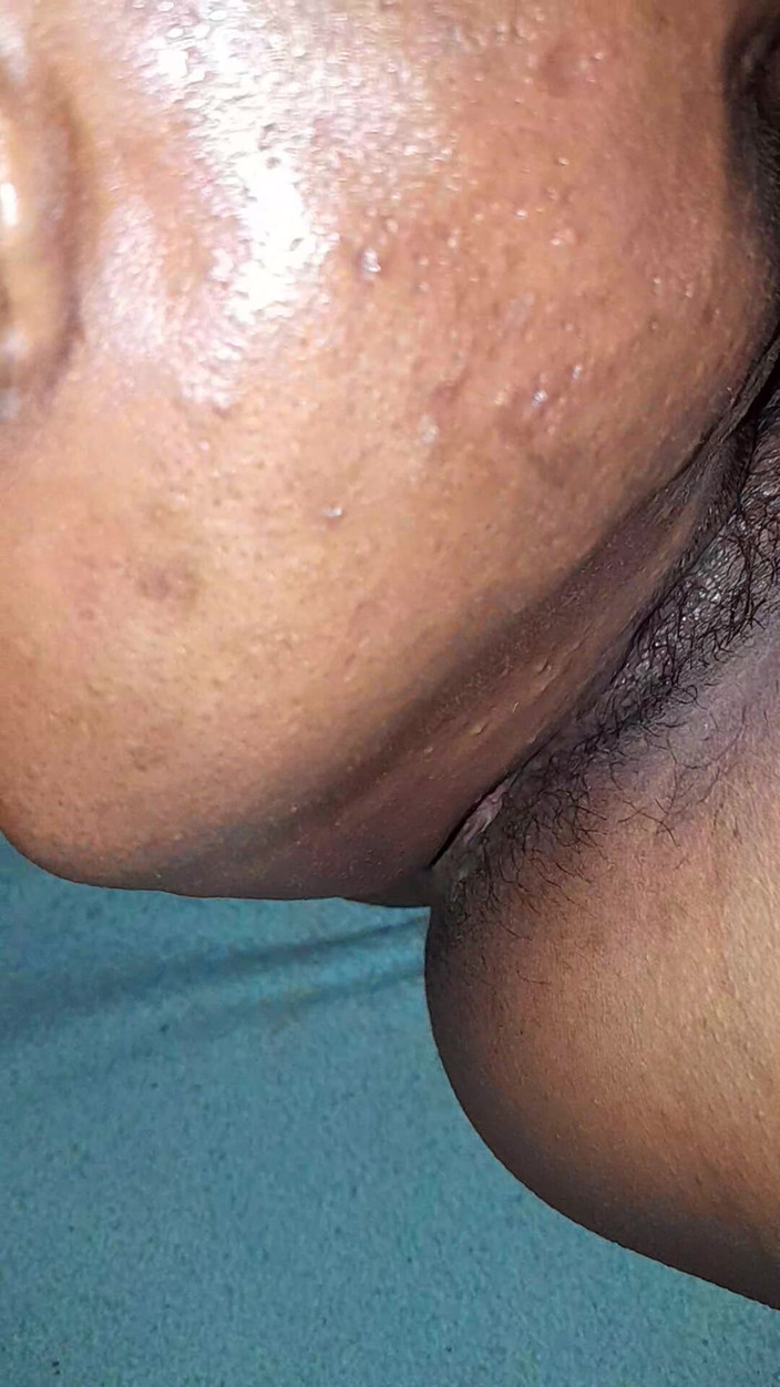 Mukesh730: Mukesh730