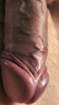 Throbbing