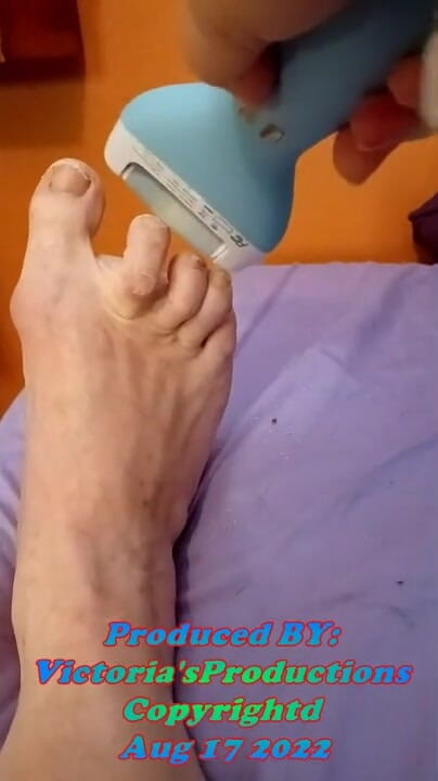 BBW nurse Vicki adventures with friends: Good morning part 2 pov toe care lotion