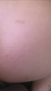 Pengecoran Anal