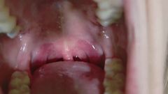 Victoria Lotus: Pikantne nici dentystyczne Języczka i Usta Wycieczka Guma Rozciąganie Zmysł