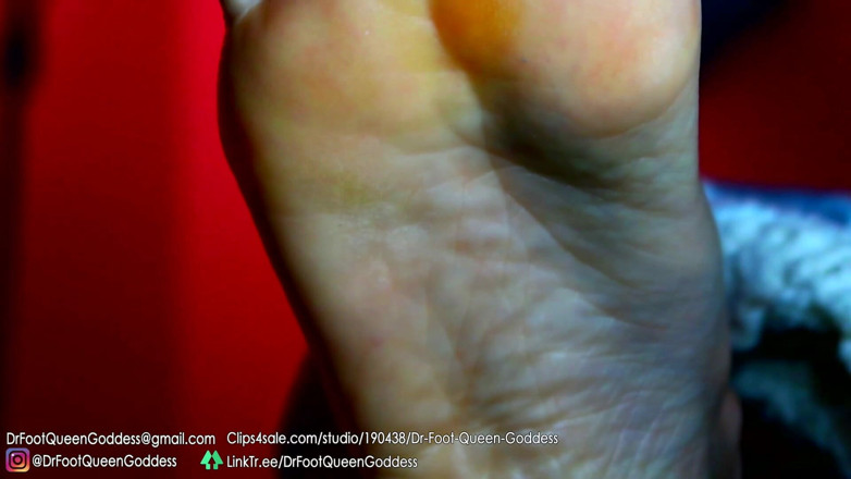 Dr. Foot Queen Goddess: Urut losyen tapak berkedut bahagian 2