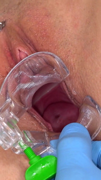The Cervix of Daphne Klyde Is Exposed to the Whole World