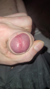 Penis