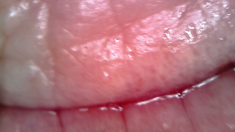 Nicoletta Embassi: Exame Endoscópio Médico Oral: Gozada, Dentes Extremos E Macro Da...