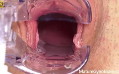 Cervix of Shy MILF Revealed!