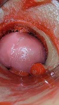 Kamera in Tiefe Muschi Fängt Überdosis Ejakulation Von Sperma Asmr Ein