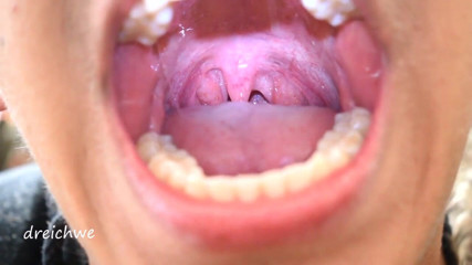 Dreichwe: Uvula fetish mouth