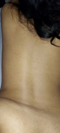 Vanessinha Called Me and When I Arrived She Was Like This with Her Back Like This