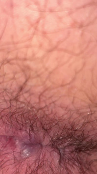 Close up Ass