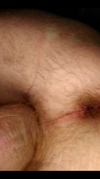 My Anal