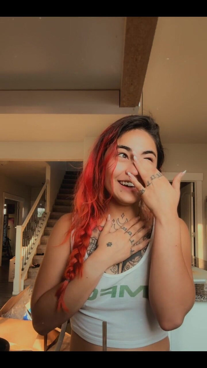 lilRavenFox: Omg a Long Lil Update My Foot Is Healing!