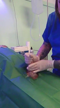 Medical Handjob