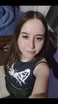 Do You Like My Freckles This Close-up of My Face as I Dance to the Music