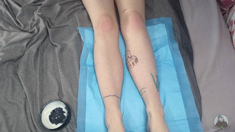 Alice Bean: Nožní doktor