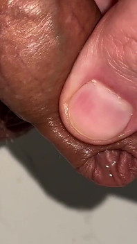 Playing with Foreskin While Peeing