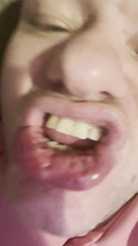 Tongue Crazy
