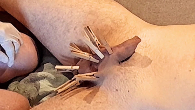 Master Drex: Wäscheklammern, sondieren, melken